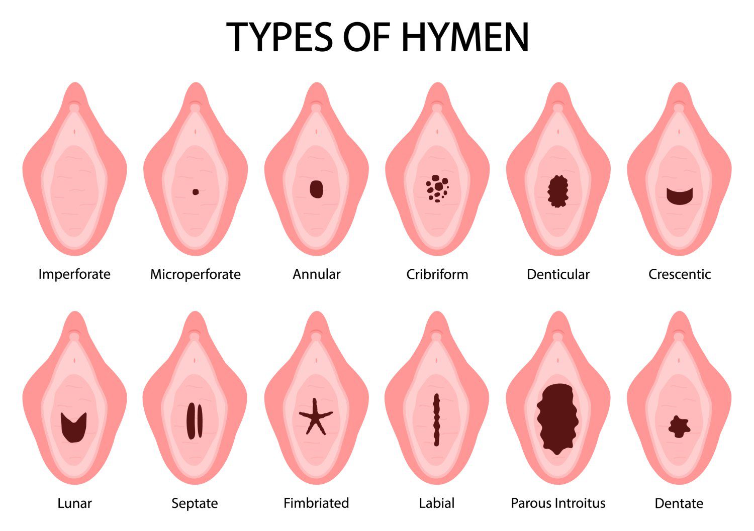 labios vaginais